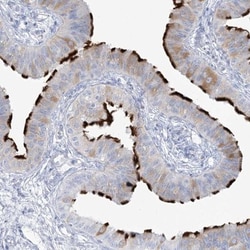 ADGB Antibody, Novus Biologicals 25 &mu;L, Unlabeled:Antibodies, Polyclonal