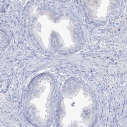 ADGB Antibody, Novus Biologicals 25 &mu;L, Unlabeled:Antibodies, Polyclonal