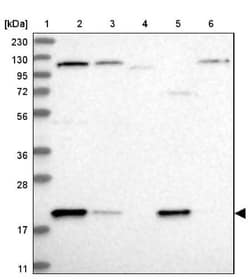 ADI1 Antibody, Novus Biologicals:Antibodies:Primary Antibodies
