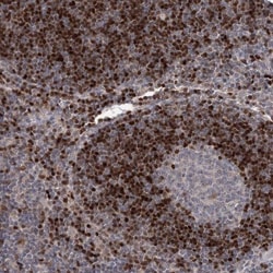 ADK Antibody, Novus Biologicals 25 &mu;L; Unlabeled:Antibodies, Polyclonal