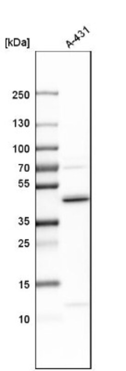 ADK Antibody, Novus Biologicals 25 &mu;L; Unlabeled:Antibodies, Polyclonal