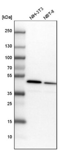 ADK Antibody, Novus Biologicals 25 &mu;L; Unlabeled:Antibodies, Polyclonal