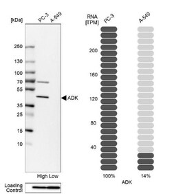 ADK Antibody, Novus Biologicals 25 &mu;L; Unlabeled:Antibodies, Polyclonal
