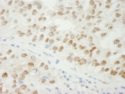 ADNP Antibody, Novus Biologicals 0.1 mL | Buy Online | Novus Biologicals | Fisher Scientific
