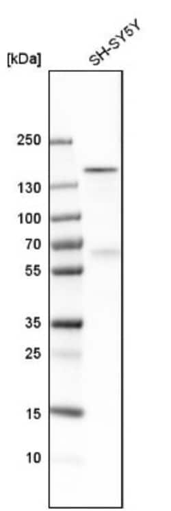 ADNP Antibody, Novus Biologicals 25 &mu;L; Unlabeled:Antibodies, Polyclonal