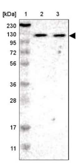 ADNP2 Antibody, Novus Biologicals:Antibodies:Primary Antibodies