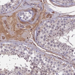ADO Antibody, Novus Biologicals 25 &mu;L; Unlabeled:Antibodies, Polyclonal