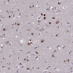 ADO Antibody, Novus Biologicals 25 &mu;L; Unlabeled:Antibodies, Polyclonal