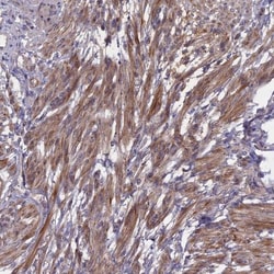 ADO Antibody, Novus Biologicals 25 &mu;L; Unlabeled:Antibodies, Polyclonal