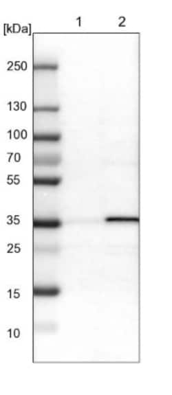 ADP-Sugar Pyrophosphatase/NUDT5 Antibody, Novus Biologicals 0.1mL; Unlabeled:Antibodies,
