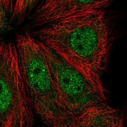 ADPRHL1 Antibody, Novus Biologicals 0.1mL; Unlabeled:Antibodies, Polyclonal