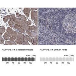 ADPRHL1 Rabbit anti-Human, Polyclonal, Novus Biologicals 100 &mu;g; Unconjugated:Antibodies,