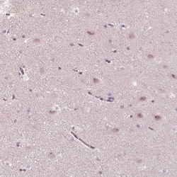 ADPRHL1 Antibody, Novus Biologicals 0.1mL; Unlabeled:Antibodies, Polyclonal