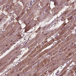 ADPRHL1 Antibody, Novus Biologicals 0.1mL; Unlabeled:Antibodies, Polyclonal