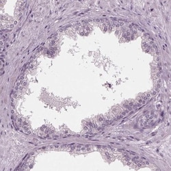 ADPRHL1 Antibody, Novus Biologicals 0.1mL; Unlabeled:Antibodies, Polyclonal