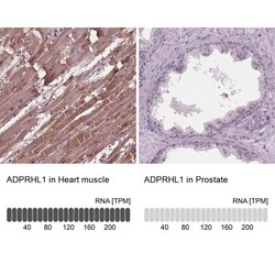 ADPRHL1 Antibody, Novus Biologicals 0.1mL; Unlabeled:Antibodies, Polyclonal