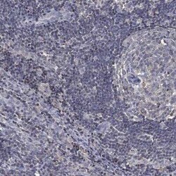 ADPRHL1 Rabbit anti-Human, Polyclonal, Novus Biologicals 100 &mu;g; Unconjugated:Antibodies,