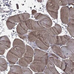ADPRHL1 Rabbit anti-Human, Polyclonal, Novus Biologicals 100 &mu;g; Unconjugated:Antibodies,