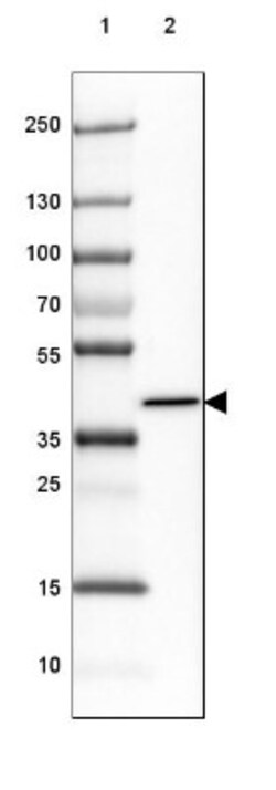 ADPRHL1 Antibody, Novus Biologicals 0.1mL; Unlabeled:Antibodies, Polyclonal