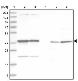 ADPRHL2 Antibody, Novus Biologicals 0.1mL; Unlabeled:Antibodies, Polyclonal