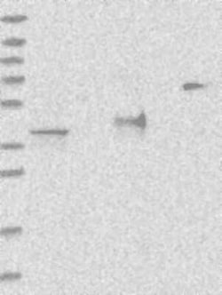 ADPRHL2 Rabbit anti-Human, Polyclonal, Novus Biologicals 100 &mu;g | Buy Online | Bio-Techne | Fisher Scientific