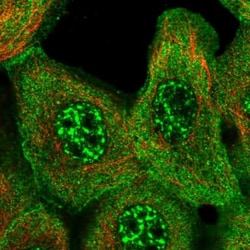 AE2 Antibody, Novus Biologicals 0.1mL; Unlabeled:Antibodies, Polyclonal