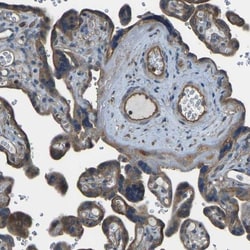 AE2 Antibody, Novus Biologicals 0.1mL; Unlabeled:Antibodies, Polyclonal