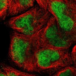 AF10 Antibody, Novus Biologicals 0.1mL; Unlabeled:Antibodies, Polyclonal