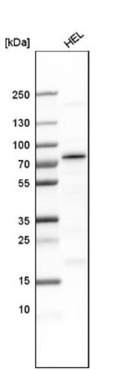 AF9 Antibody, Novus Biologicals 0.1mL; Unlabeled:Antibodies, Polyclonal