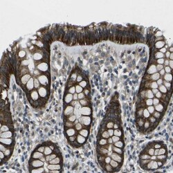 AFAP Antibody, Novus Biologicals 0.1mL; Unlabeled:Antibodies, Polyclonal