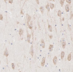 AFF2 Antibody, Novus Biologicals 0.1mL; Unlabeled:Antibodies, Polyclonal