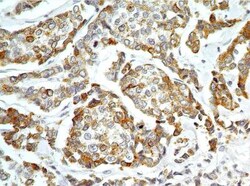 AG-2/AGR2 Antibody - Azide Free, Novus Biologicals 0.10 miligramo | Buy Online | Novus Biologicals | Fisher Scientific