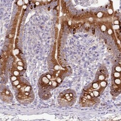 AG-3/AGR3 Antibody, Novus Biologicals:Antibodies:Primary Antibodies