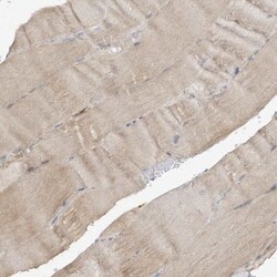 AGA Antibody, Novus Biologicals 25 &mu;L; Unlabeled:Antibodies, Polyclonal