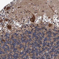 AGAP2 Antibody, Novus Biologicals 0.1mL; Unlabeled:Antibodies, Polyclonal