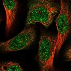AGL Antibody, Novus Biologicals 0.1mL; Unlabeled:Antibodies, Polyclonal