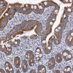 AGMAT Antibody, Novus Biologicals:Antibodies:Primary Antibodies