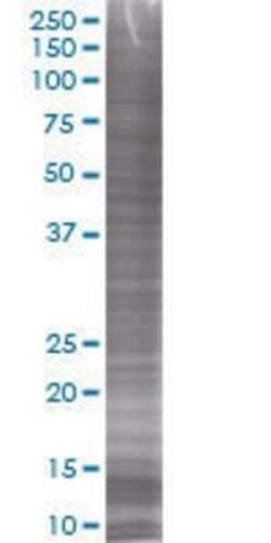 Novus Biologicals AGPAT1 293T Cell Transient Overexpression Lysate 0.1 mL | Buy Online | Novus Biologicals&trade; | Fisher Scientific