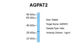 AGPAT2 Antibody, Novus Biologicals 0.1mg; Unlabeled:Antibodies, Polyclonal