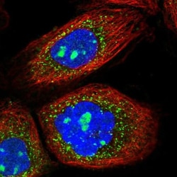 AGPS Antibody, Novus Biologicals:Antibodies:Primary Antibodies