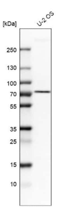 AGPS Antibody, Novus Biologicals:Antibodies:Primary Antibodies
