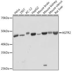 AGTR-2 Rabbit anti-Human, Mouse, Rat, Clone: 0V7Y3, Novus Biologicals 20 &mu;g | Buy Online | Novus Biologicals | Fisher Scientific
