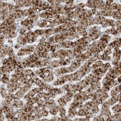 AGXT Antibody, Novus Biologicals:Antibodies:Primary Antibodies