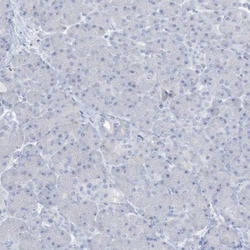 AGXT Antibody, Novus Biologicals:Antibodies:Primary Antibodies