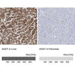 AGXT Antibody, Novus Biologicals:Antibodies:Primary Antibodies
