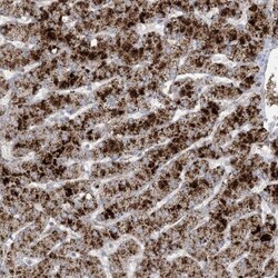 AGXT Antibody, Novus Biologicals:Antibodies:Primary Antibodies
