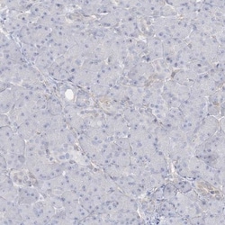 AGXT Antibody, Novus Biologicals:Antibodies:Primary Antibodies