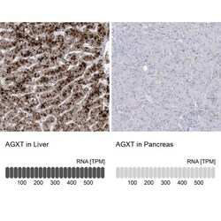 AGXT Antibody, Novus Biologicals:Antibodies:Primary Antibodies