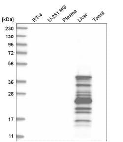 AGXT Antibody, Novus Biologicals:Antibodies:Primary Antibodies
