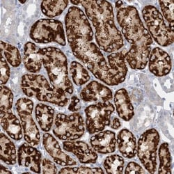 AGXT2 Antibody, Novus Biologicals:Antibodies:Primary Antibodies